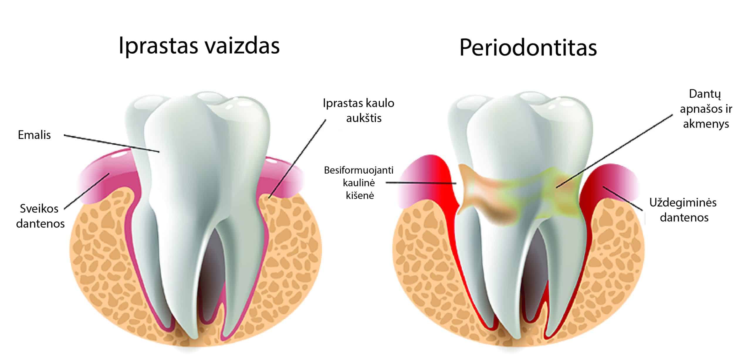 Periodontologinis gydymas