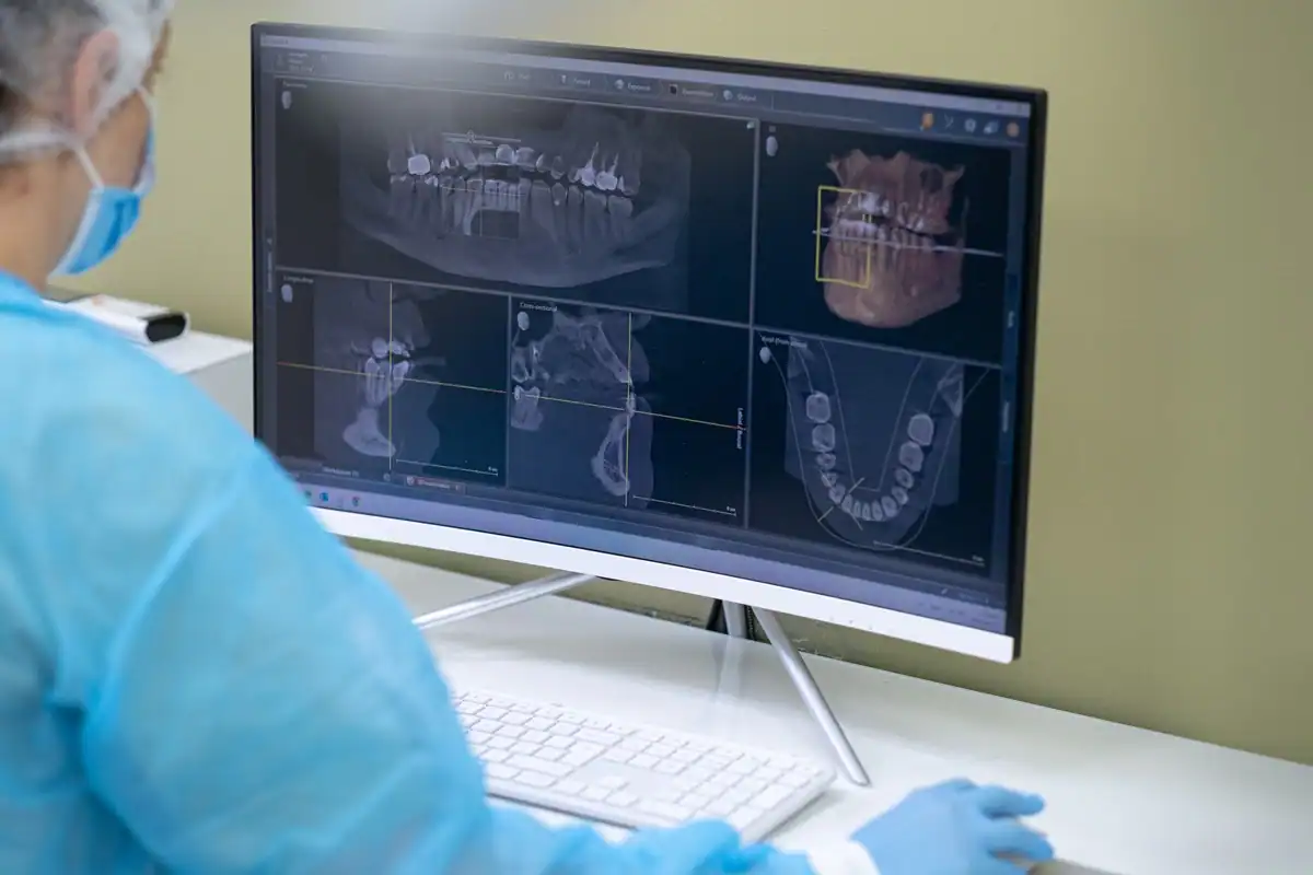 Dantų rentgeno nuotrauka, rodanti odontologijos klinikos diagnostikos procesą.